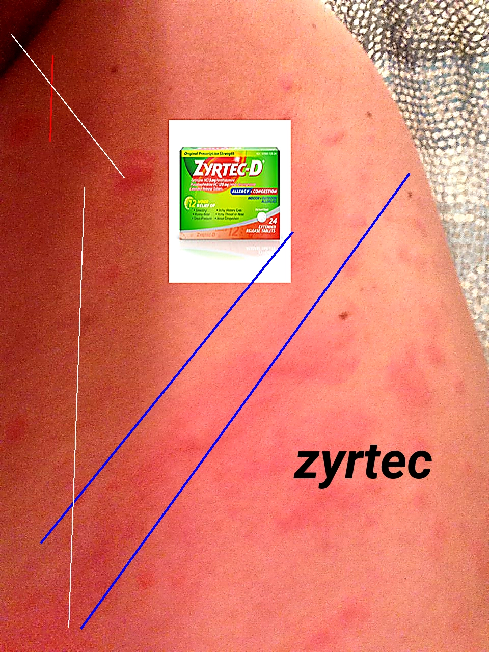 Zyrtec comprimés prix